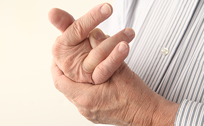 Arthritis