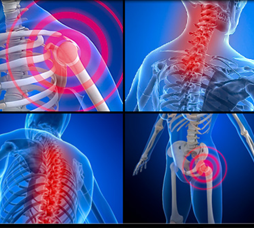 Chiro-Lifestyle | What do I Treat?